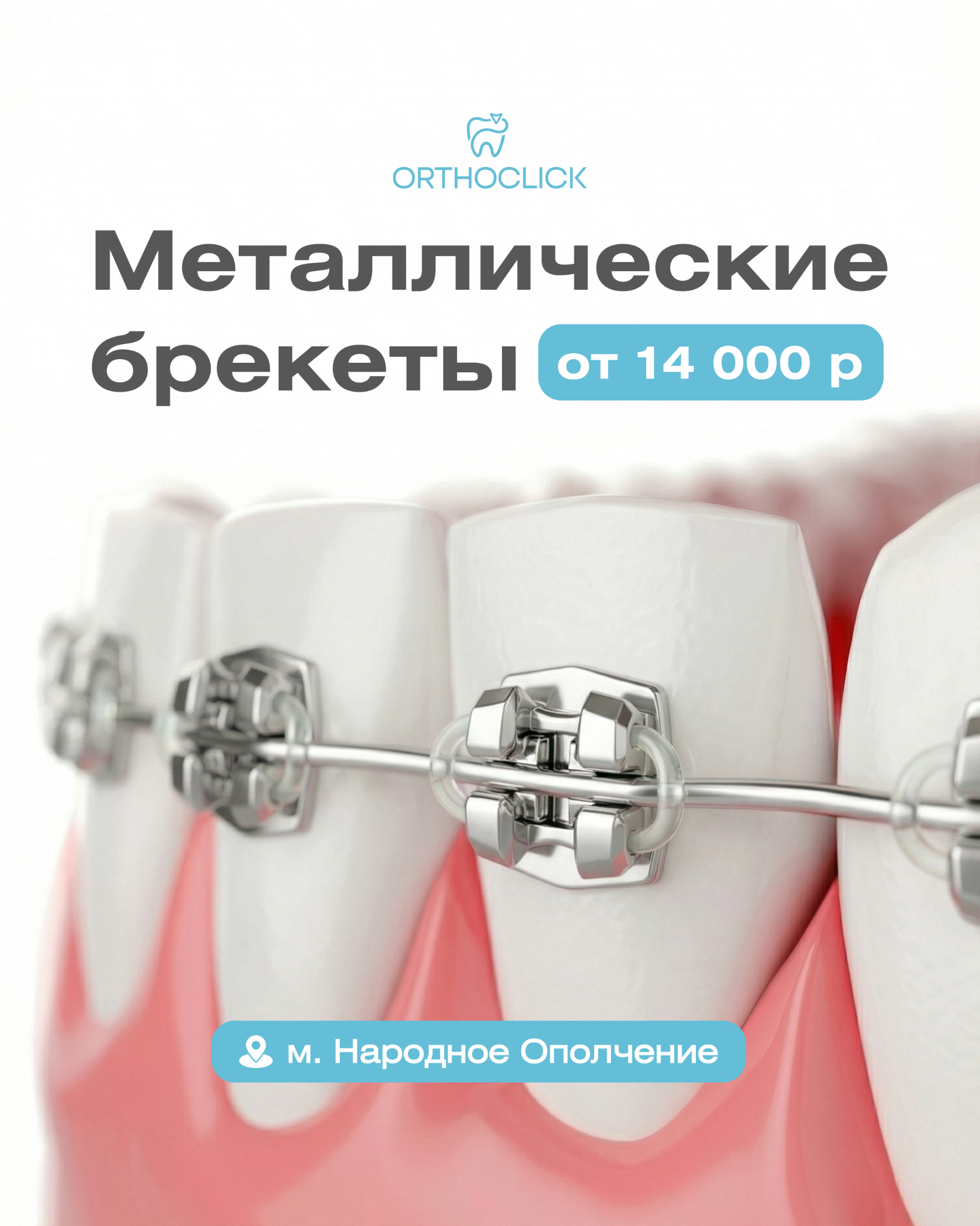 Рекламный креатив: Металлические брекеты от 14 000 ₽
